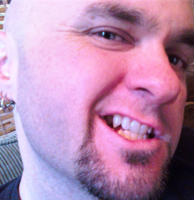 teefs